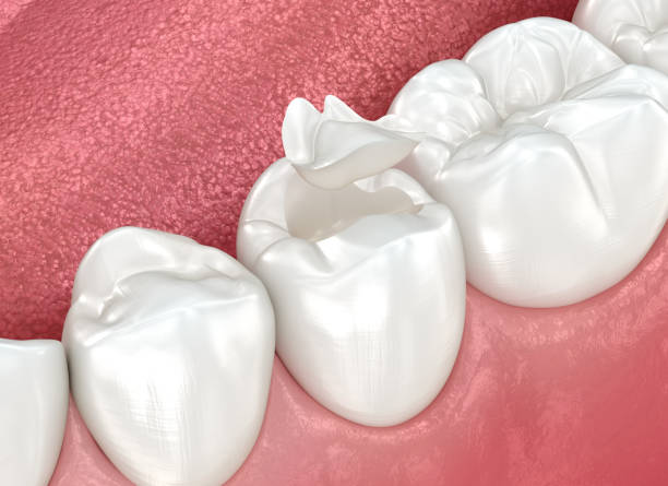 Best Tooth Extraction  in Beaver Creek, TX